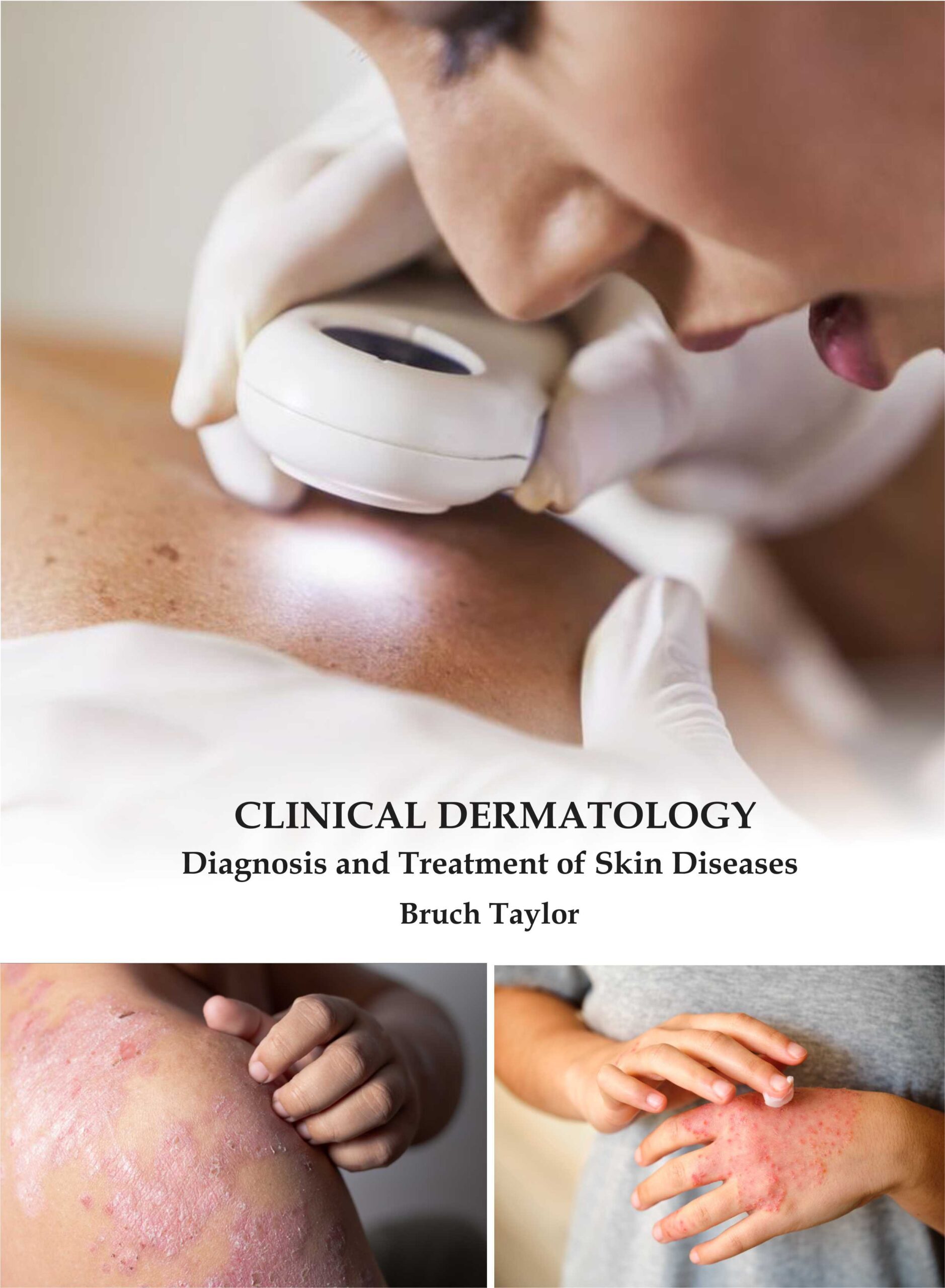 dermatology